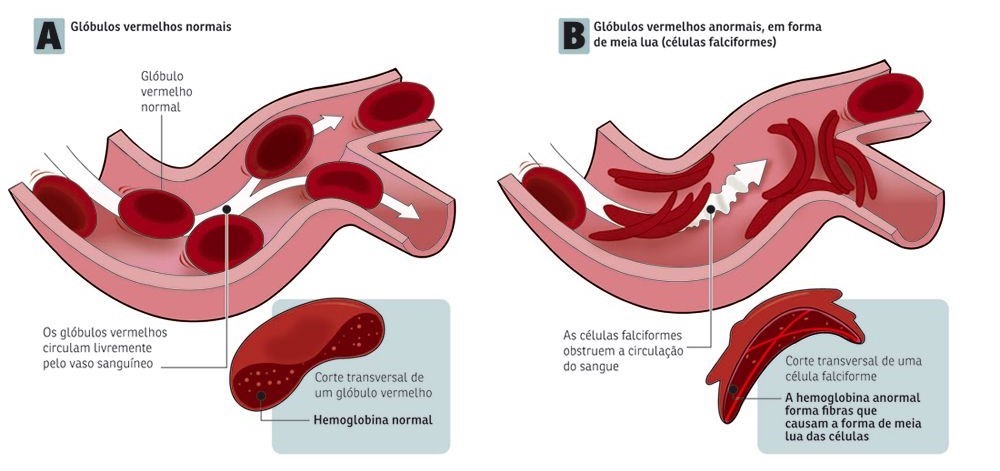 ANEMIA 
PEDIATRIA 
PEDIATRA EM SALVADOR 